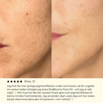 SheBloom® Face Firming Oil