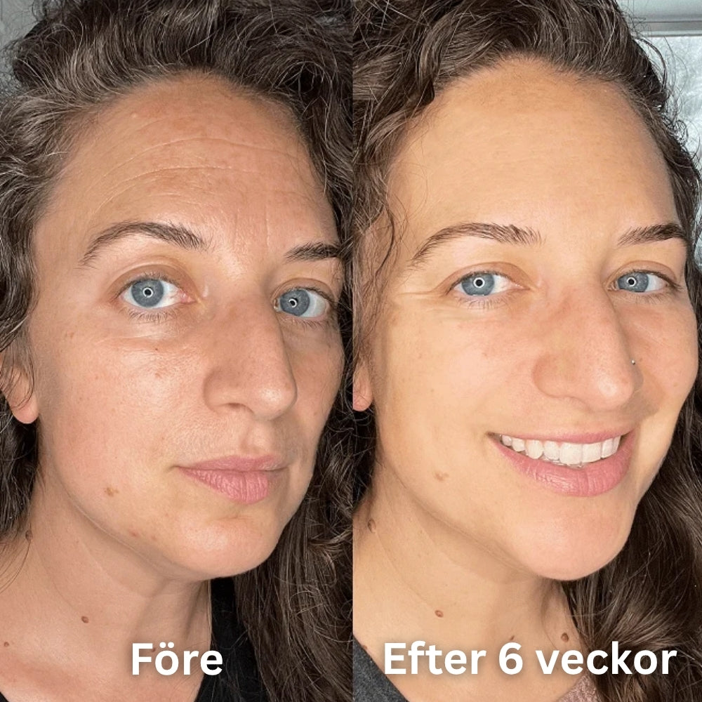 SheBloom® Face Firming Oil