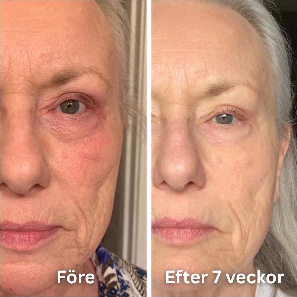 SheBloom® Face + Neck Firming Oil