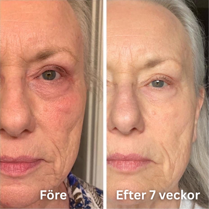 SheBloom® Face + Neck Firming Oil