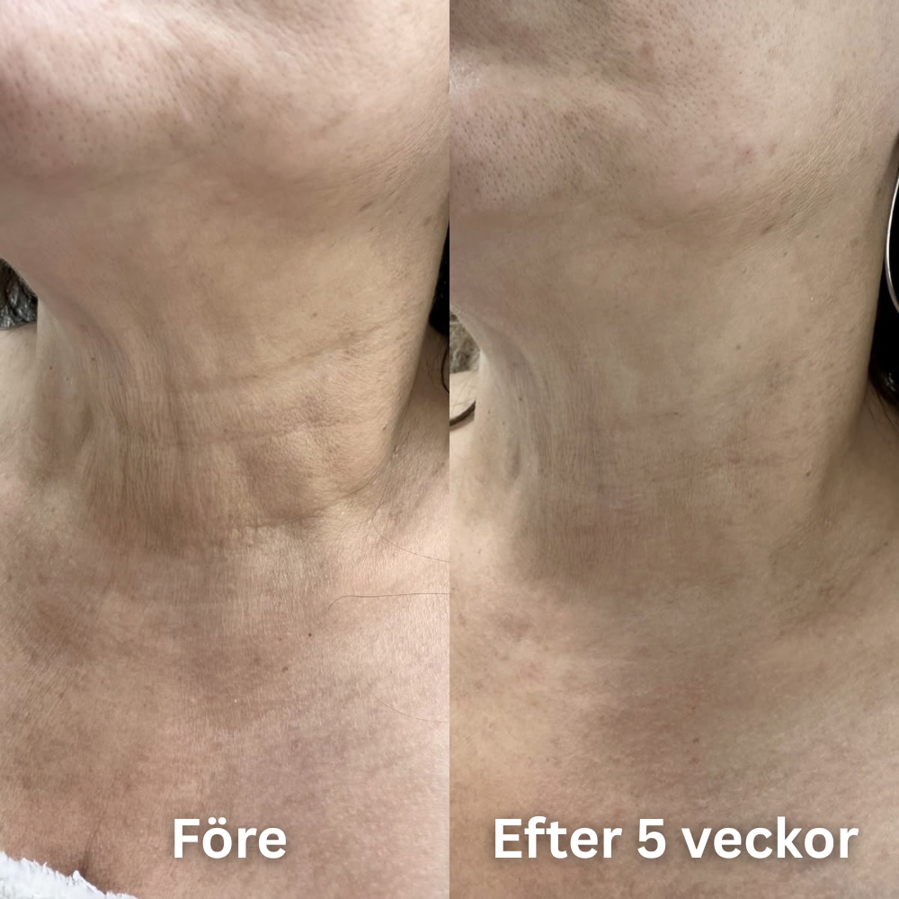 SheBloom® Face + Neck Firming Oil