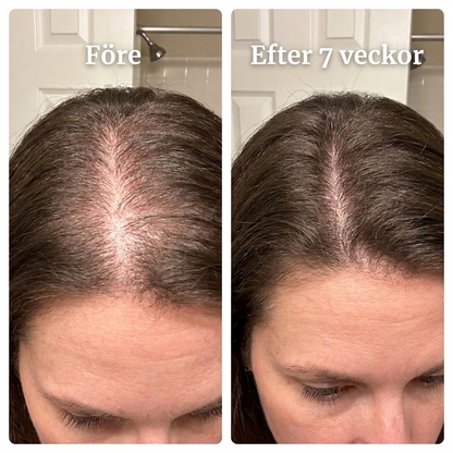 SheBloom® Rice & Rosemary Growth Mist